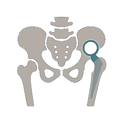 Αρθροπλαστική