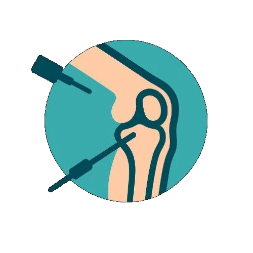 Αρθροσκόπηση