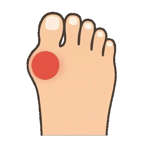 Διορθωτικές Επεμβάσεις Άκρου Ποδός