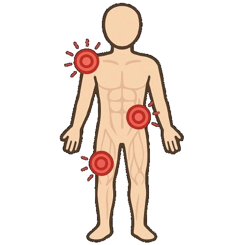 Επώδυνα Μυοσκελετικά Σύνδρομα
